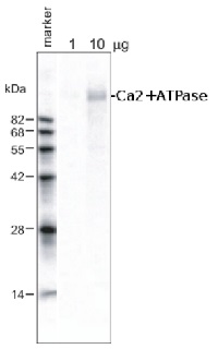 Ca2+-ATPase | Calmodulin-stimulated calcium-ATPase in the group Antibodies for Plant/Algal  / Membrane Transport System / Plasma membrane at Agrisera AB (Antibodies for research) (AS09 486)